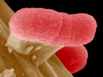 Crece resistencia de 12 bacterias a antibióticos: OMS