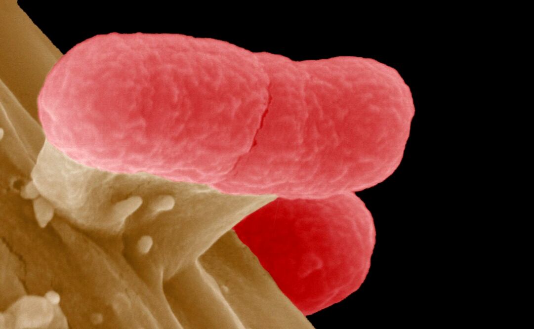 Una bacteria EHEC, una cepa de la bacteria Escherichia coli de alta resistencia a los antibióticos. (Archivo. EL UNIVERSAL)