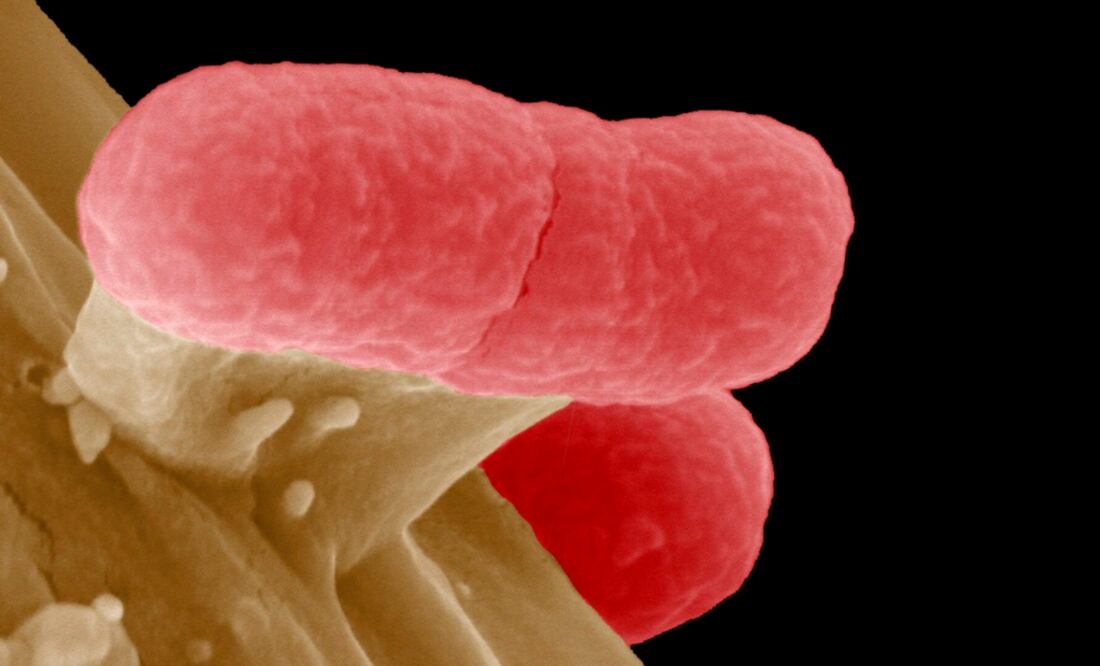 Una bacteria EHEC, una cepa de la bacteria Escherichia coli de alta resistencia a los antibióticos. (Archivo. EL UNIVERSAL)