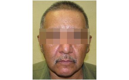 Detienen a supuesto veterinario en Sonora; lo acusan de provocar muerte de perrito mientras lo castraba