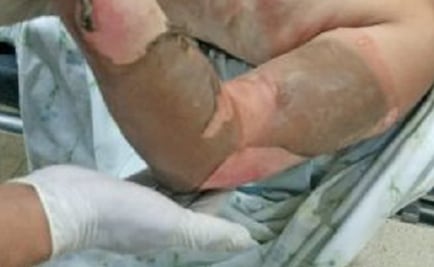 Llega ebrio a casa y quema viva a su esposa en Chalco 