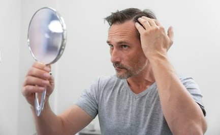 La pérdida de cabello en hombres: causas y soluciones
