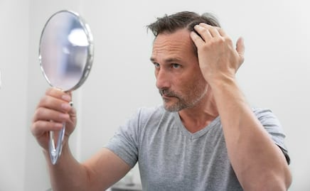 La pérdida de cabello en hombres: causas y soluciones
