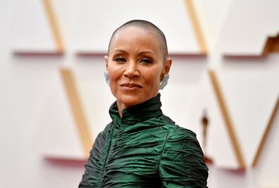 ¿Qué es la alopecia? Enfermedad que padece Jada Pinkett Smith