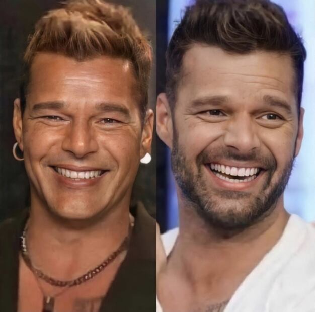 ¿Qué les pasó en la cara? Estos 5 artistas han recurrido a procedimientos estéticos