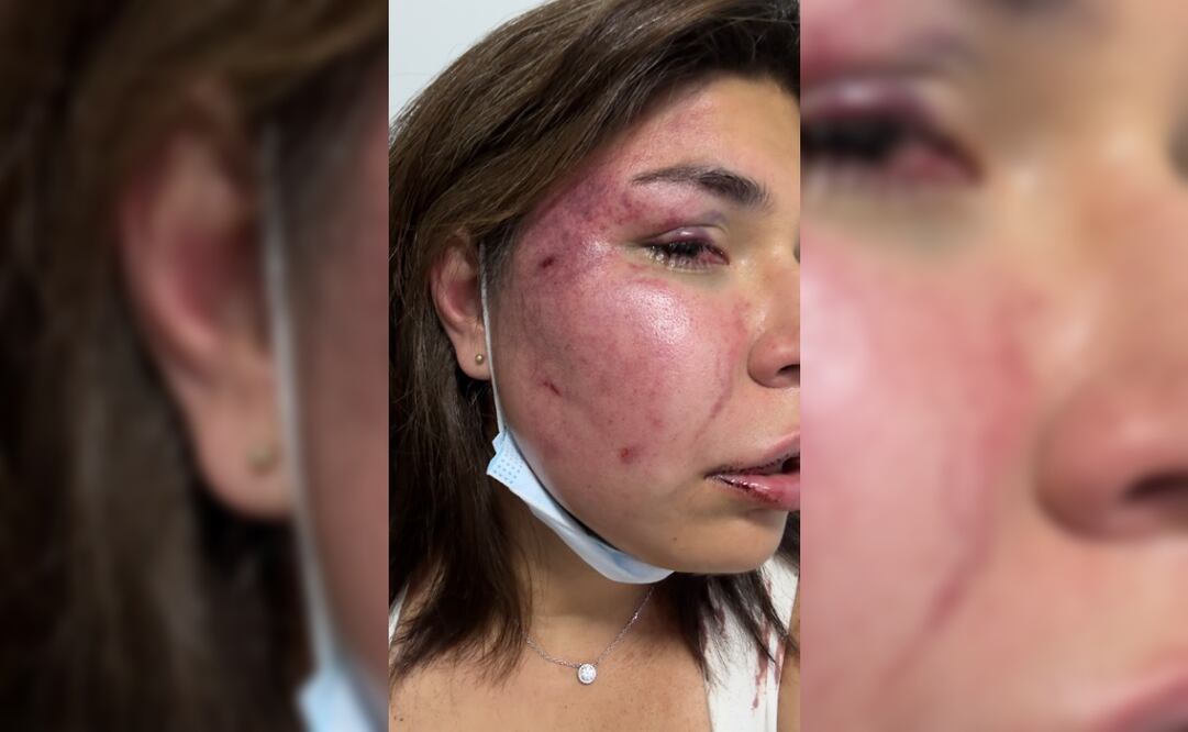 Foto: tomada de X, @valhekker