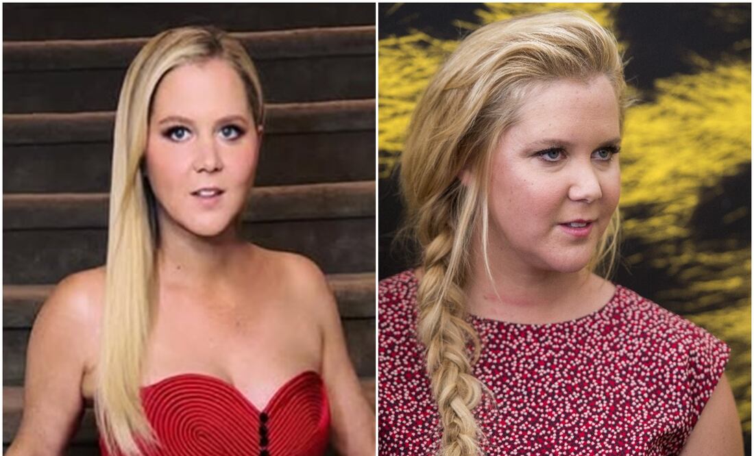 Amy Schumer ahora y antes respectivamente. Foto: Instagram amyschumer.