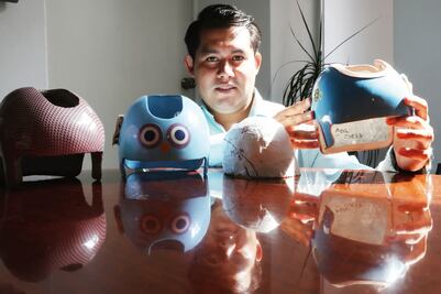 Ingeniero biónico desarrolla casquitos contra deformaciones