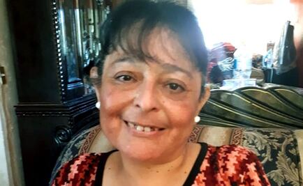 Doña Rosa ha vuelto a sonreír luego de extirparle un tumor de la mejilla  