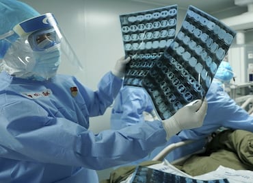 COVID-19 vs the human immune system, a microscopic war with major health consequences