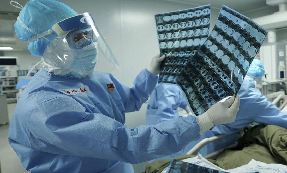 A medical worker looks at CT scans at the Huoshenshan field hospital in Wuhan – Photo: Wang Yuguo/Xinhua via AP