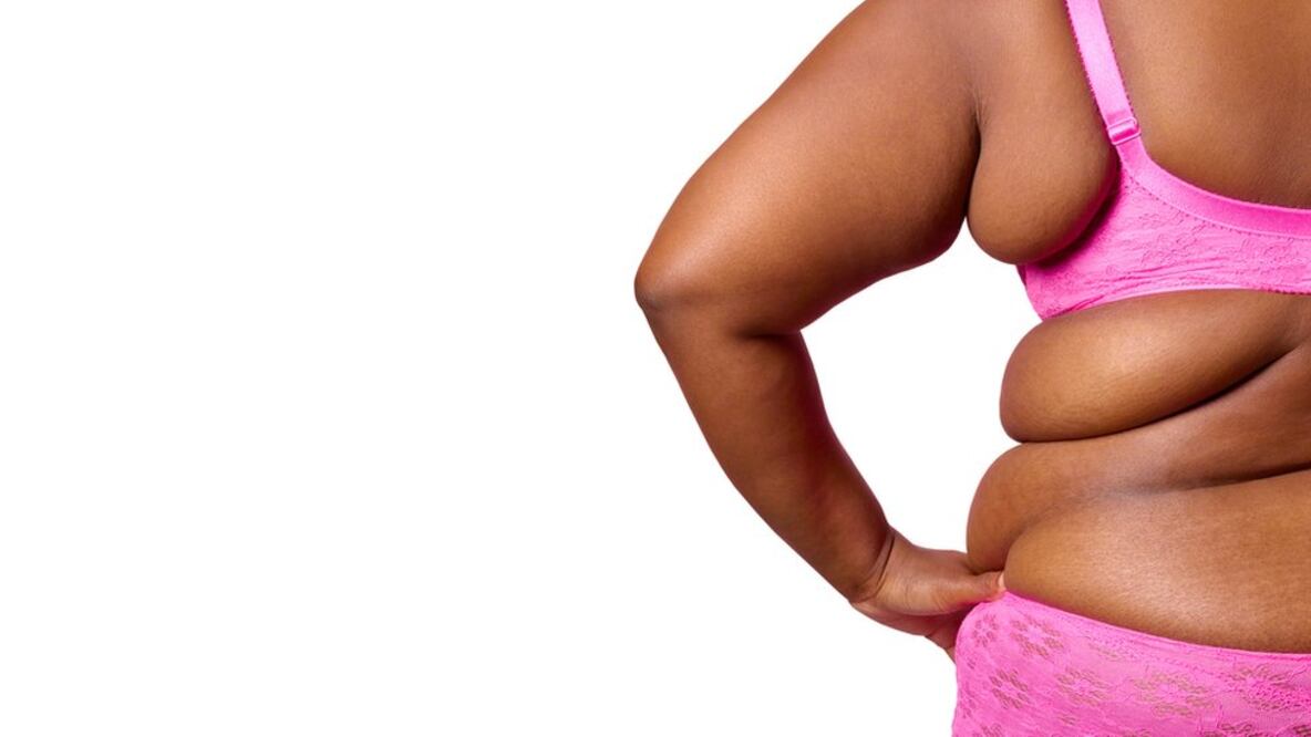 Índice de masa corporal: cómo el método que usamos para definir la obesidad podría estar equivocado