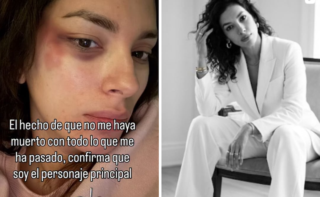 La muerte de la reconocida líder digital y excongresista ocurre semanas después de exponer agresiones psicológicas y físicas en sus redes sociales, lo que abre el debate sobre la salud mental y la protección a las víctimas.
Foto: Captura de pantalla en redes sociales.