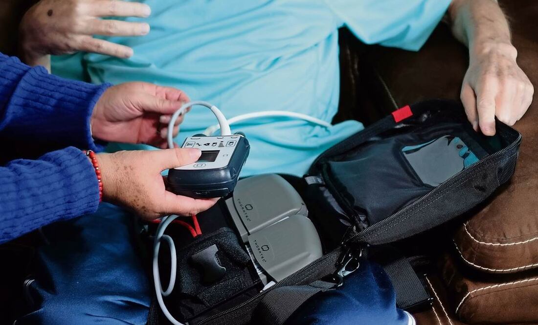 Las enfermedades cerebrovasculares cobraron 18 mil 19 víctimas durante el primer semestre de 2024 en México. (23/01/2025) Foto: Archivo | El Universal