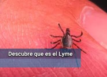 ¿Qué es es la enfermedad de "Lyme"?