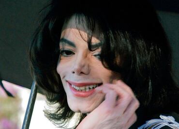 Michael Jackson murió calvo y con cicatrices en el cuerpo