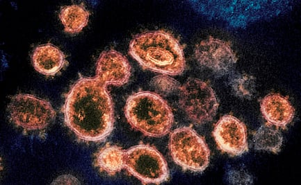 Niveles elevados de anticuerpos protegen del covid durante seis meses: estudio