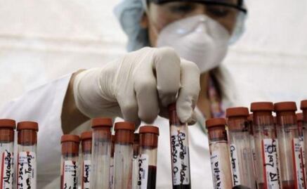 Desarrollan terapia inmunológica para controlar el VIH