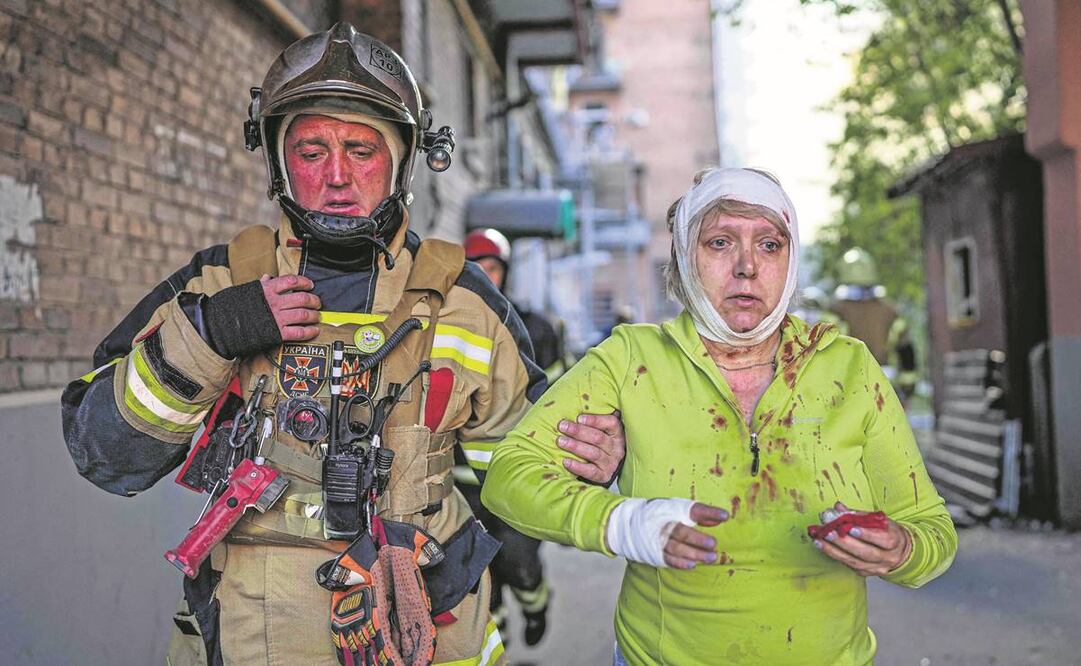 Una mujer herida, tras el ataque con misiles en Kiev. 