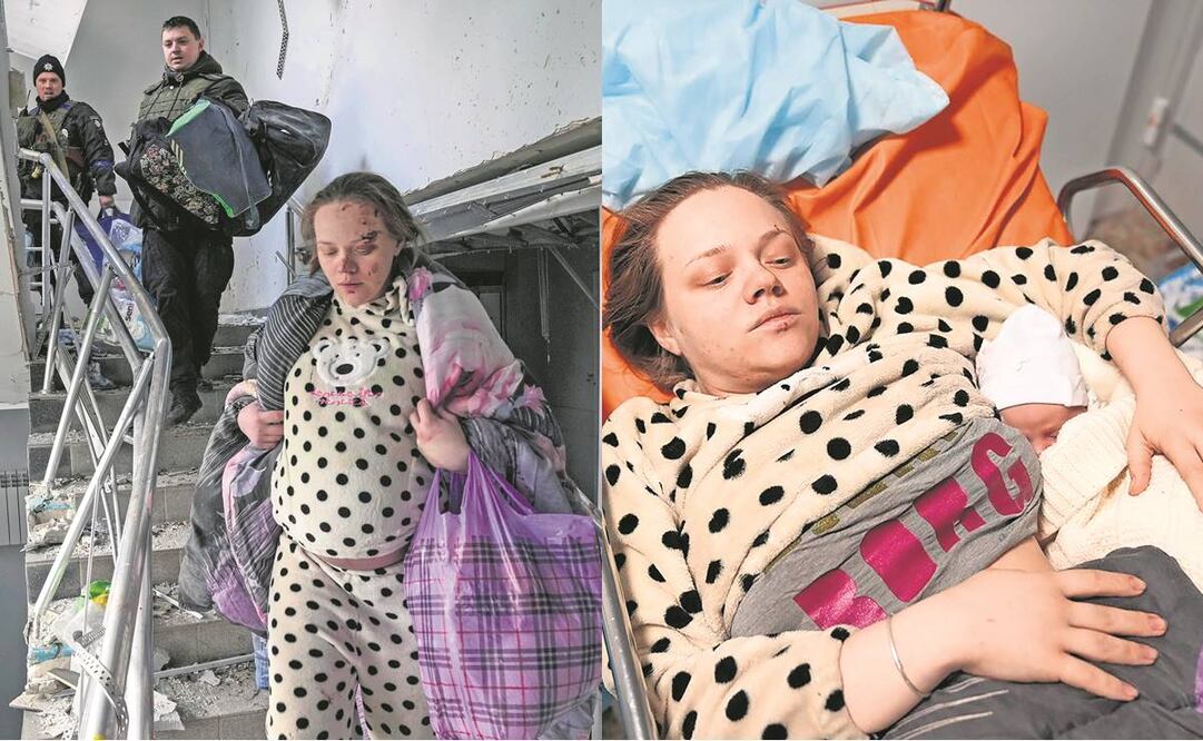 La ucranania Mariana Vishegirskaya sobrevivió a un bombardeo ruso a un hospital; el jueves dio a luz a una niña. Foto: Evgeniy Maloletka/ AP.