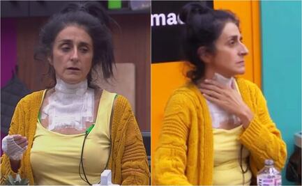 ¿Qué le pasó a Bárbara Torres, tras accidente en la cocina de "LCDLFM"?