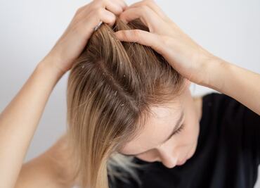 La razón por la que te pica el cuero cabelludo