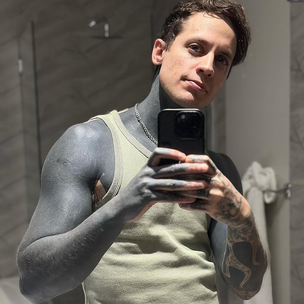 El revival emo que acompaña el regreso de Kudai (Pablo Holman)