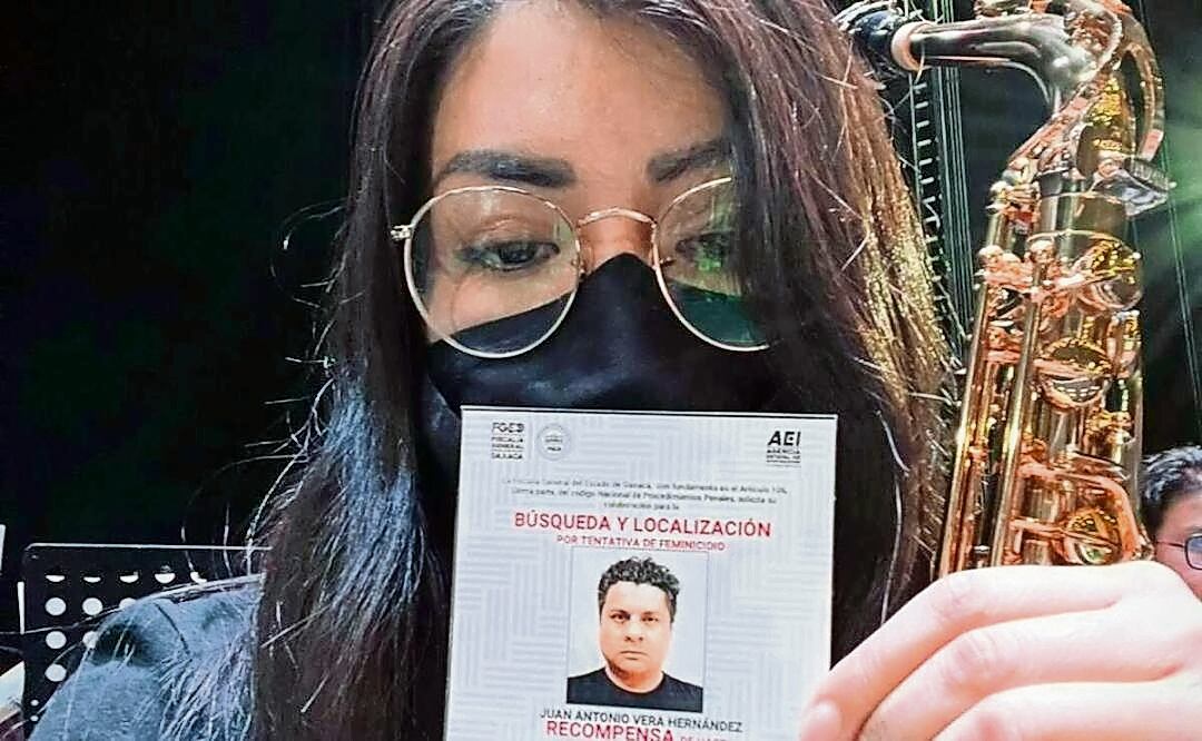 La saxofonista María Elena Ríos fue víctima de una tentativa de feminicidio a través de un ataque con ácido. Foto Especial