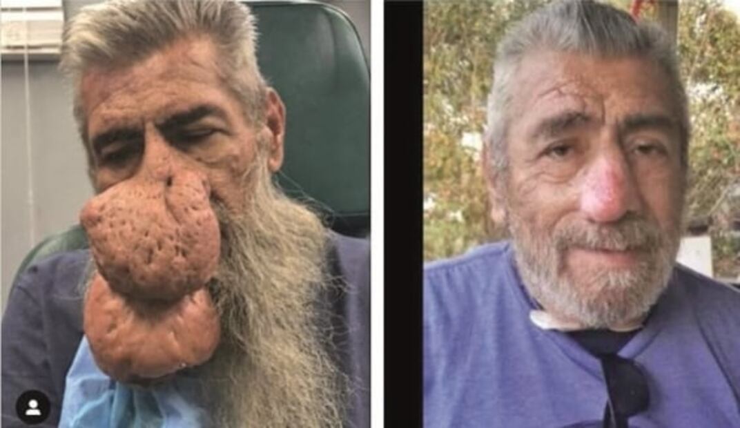 Sandra Lee exprime la belleza de una piel sana