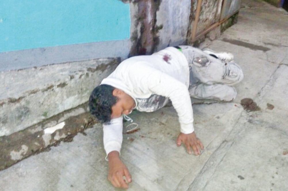 Indagatorias. Uno de los supuestos ladrones, César “N”, fue trasladado a un hospital para su atención médica; está en calidad de detenido. (ESPECIAL)