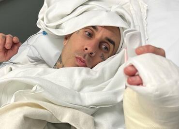 Blink-182: Travis Barker sube impactante fotografía de la operación en su dedo tras cancelación de gira