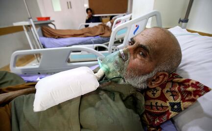 Tuberculosis, la enfermedad más contagiosa (sólo detrás del Covid-19)