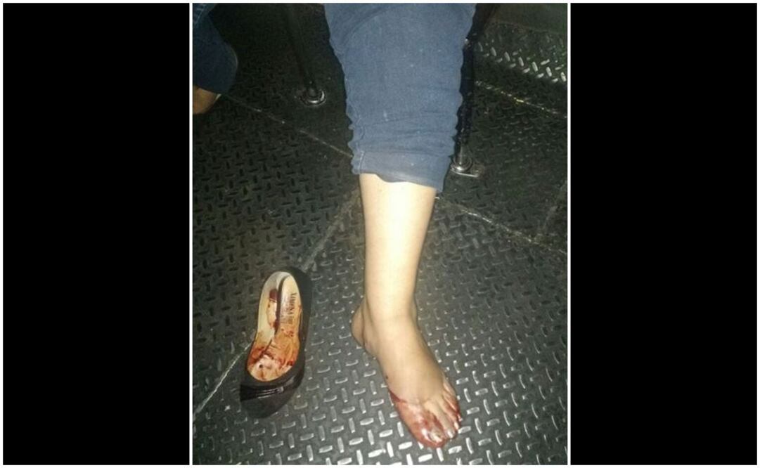 La mujer fue herida en una pierna. Foto tomada de @VillaCoapa_