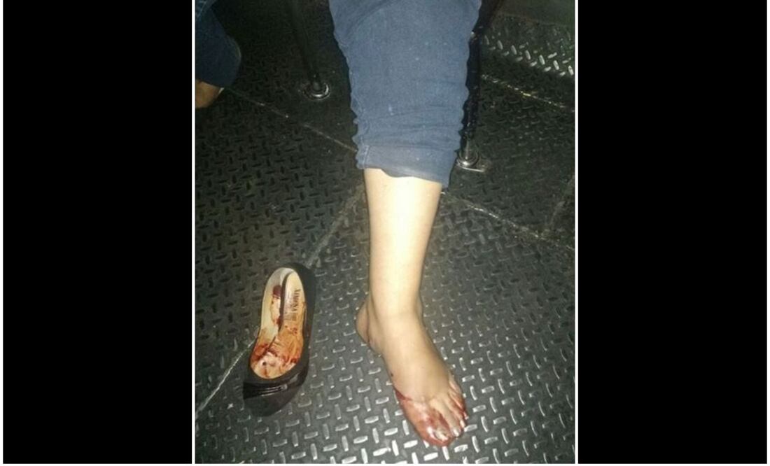 La mujer fue herida en una pierna. Foto tomada de @VillaCoapa_