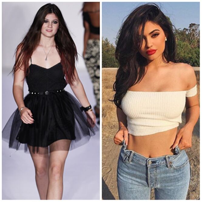 Kylie Jenner se ha hecho varias cirugías y su nuevo look le queda espectacular. (Fotos: Reuters e Instagram)
