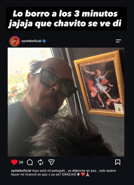 Aleks Syntek muestra su postizo en un post de redes sociales.
Foto: X