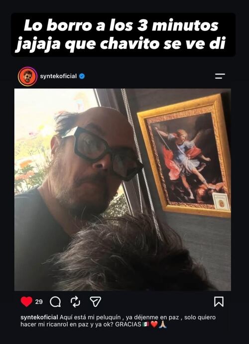 Aleks Syntek muestra su postizo en un post de redes sociales.
Foto: X