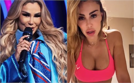 Ninel Conde da explicaciones sobre su aspecto en "¿Quién es la máscara?": "se te inflama toda la jeta, bonita no te vas a ver" 