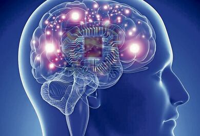 Implantes cerebrales: una revolución en la medicina
