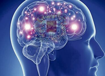 Implantes cerebrales: una revolución en la medicina