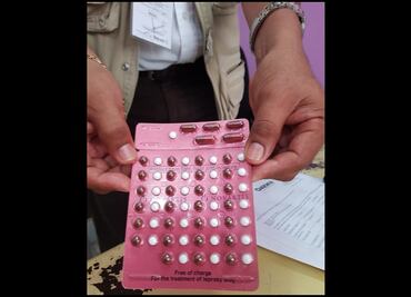 Detectan cinco casos de lepra en Oaxaca