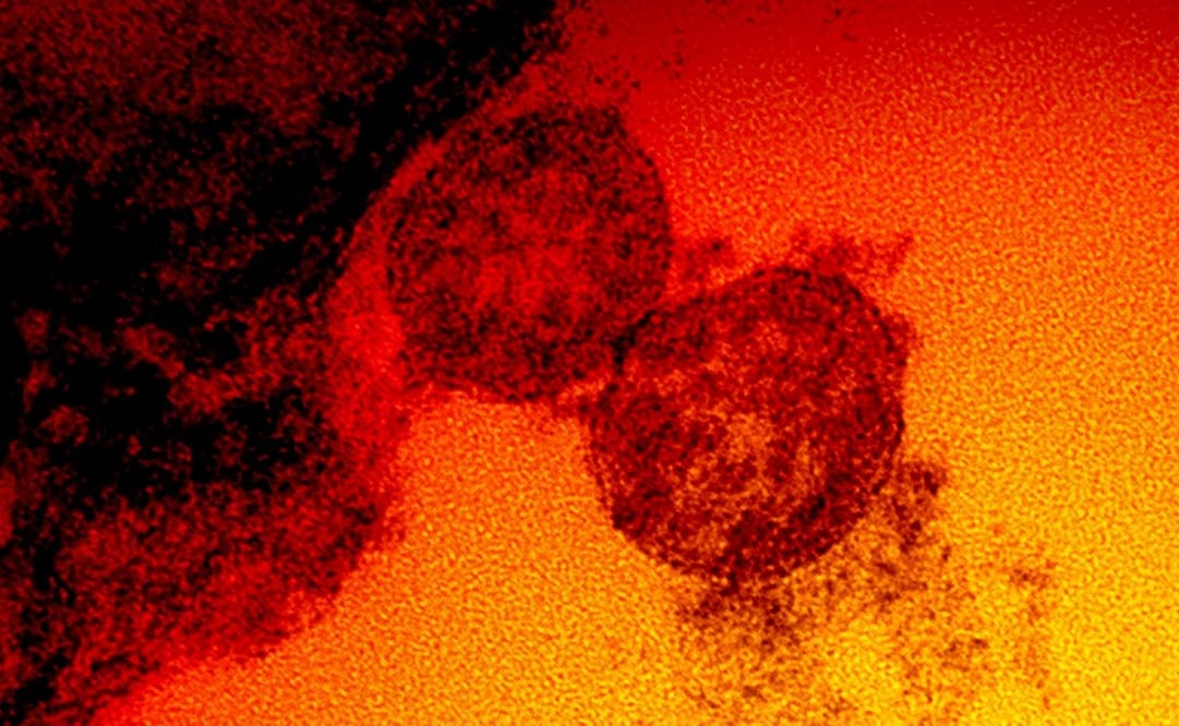 Foto: AFP /NATIONAL INSTITUTE OF ALLERGY AND INFECTIOUS DISEASES/HANDOUT 