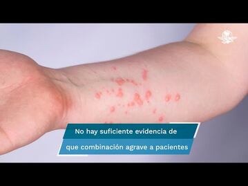 Registran a primer paciente contagiado de viruela del mono, Covid-19 y VIH al mismo tiempo