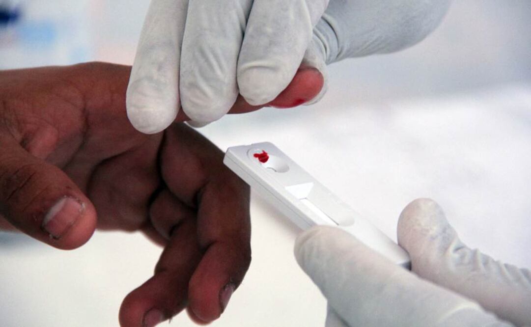 Hallan proteína en humanos inhibidora del VIH