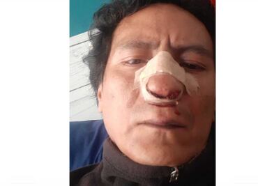 Periodista denuncia golpiza por dueños de tortillería en la colonia Roma