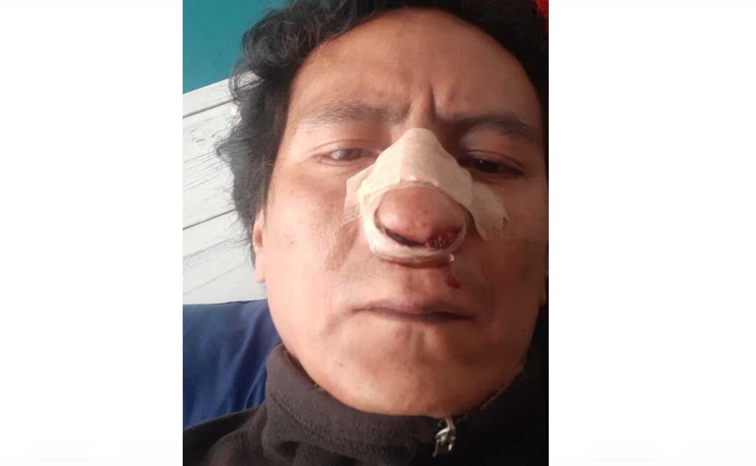 Paris Martínez fue golpeado por trabajadores de una tortillería después de pasear a su perro. Foto: Especial