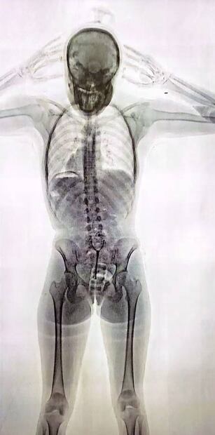 La imagen que mostraba el escáner. Foto: La Nación Argentina/GDA