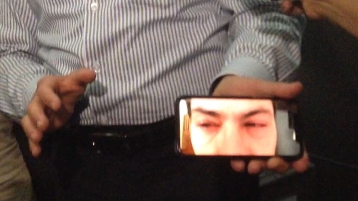 Por los reflectores. Enrique Peña Nieto mostró su teléfono con fotografías de la irritación de los ojos que padeció. (FRANCISCO RESÉNDIZ. EL UNIVERSAL)