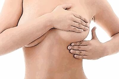 Predisposición hereditaria al cáncer de mama