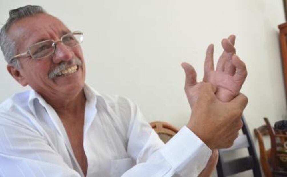 Historia. "La sangre salía como por manguera"